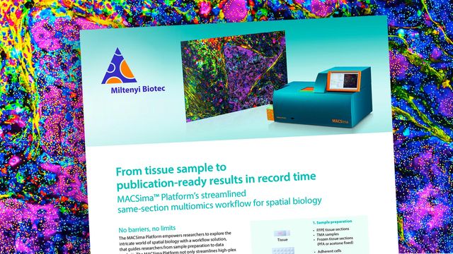Miltenyi Biotec MACSima™ platform advertisement showcasing spatial biology imaging and analysis technology