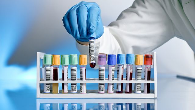 Gloved hand handling a barcoded blood sample in a laboratory setting, representing automation in sample processing. 
