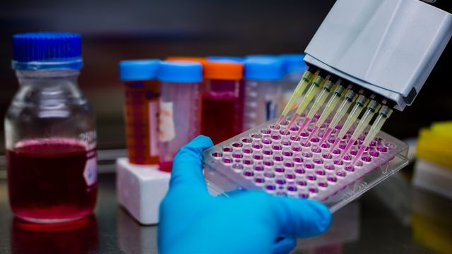 Scientist wearing blue gloves using a multichannel pipette to transfer liquid into a 96-well plate in a laboratory, with reagent bottles and test tubes in the background