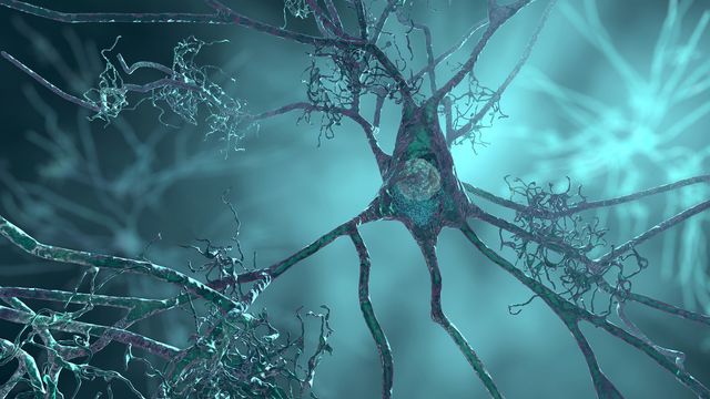 The image depicts neurons, commonly associated with Alzheimer's disease, showing the complex structures involved in cognitive functions.