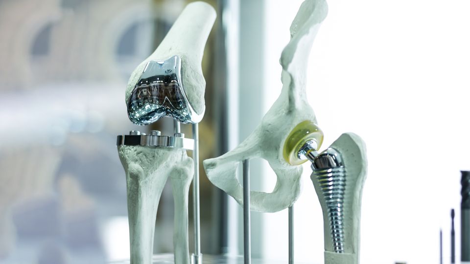 A model of two medical implant devices, a hip implant and knee implant, installed on fake bone.