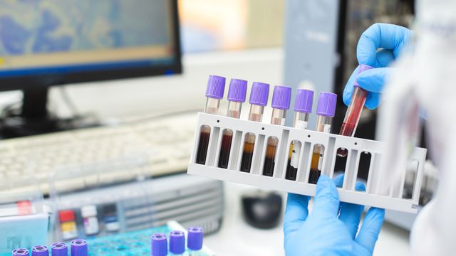 Gloved hands handling blood sample tubes in a lab, illustrating the process of liquid biopsy testing. 