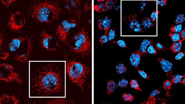 Loss of MCL-1 triggers severe mitochondrial damage (shown in the right panel). Mitochondria are shown in red, cell nuclei in blue.