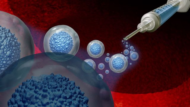 Delivery of stem cells using a syringe.