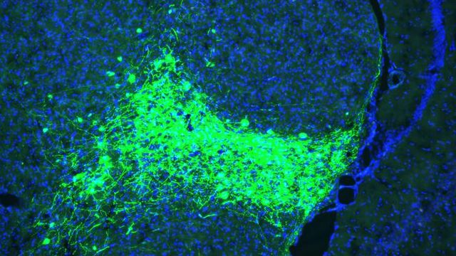 CGRP-expressing neurons (green) in the parvocellular subparafascicular nucleus (SPFp) of the thalamus.