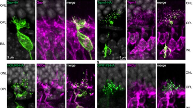 A series of fluorescence microscopy images with tagged proteins showing up in purple and green.
