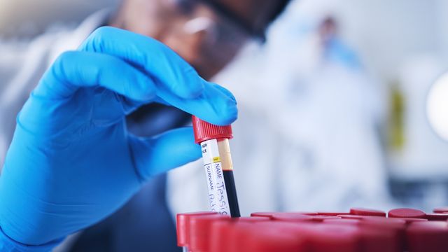 Scientist handling a blood sample vial in a laboratory for diagnostic testing.